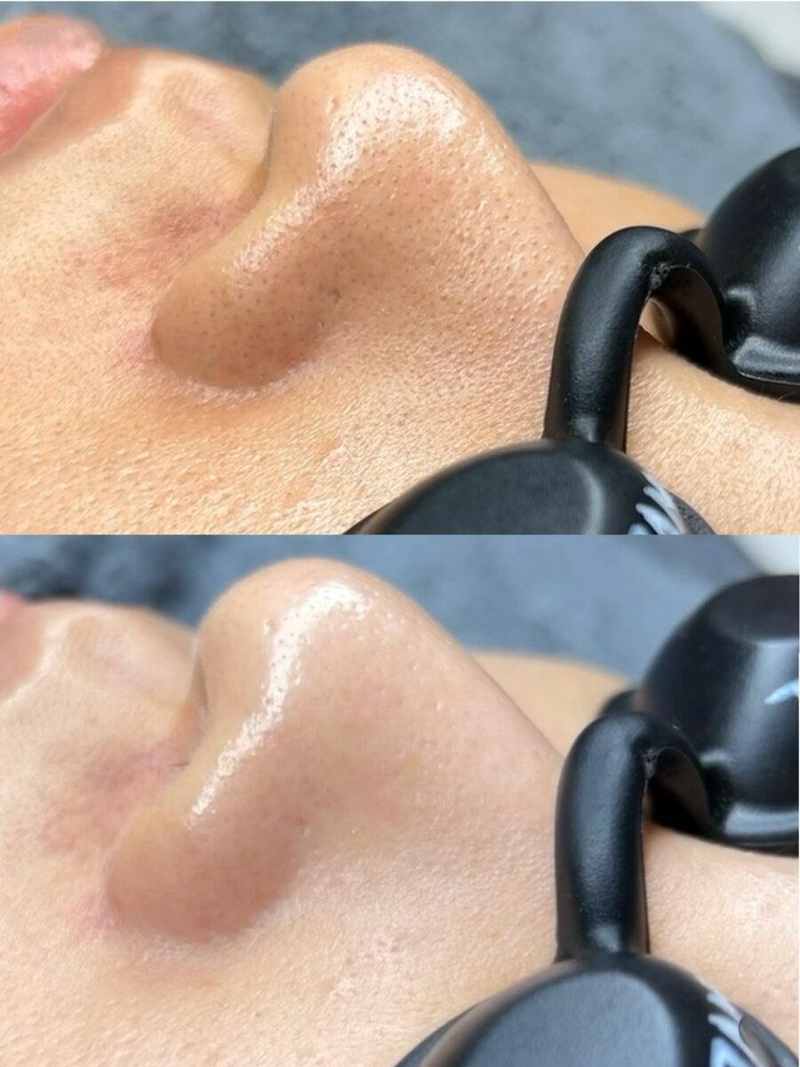 Deeply Clean & Healthy
